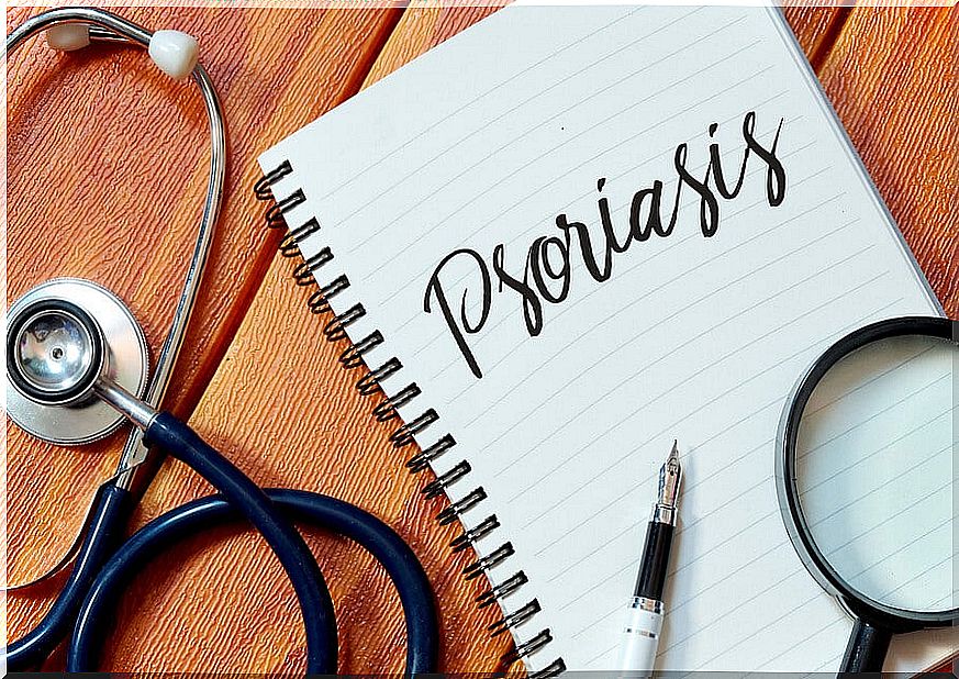 5 tips to avoid psoriasis flare-ups