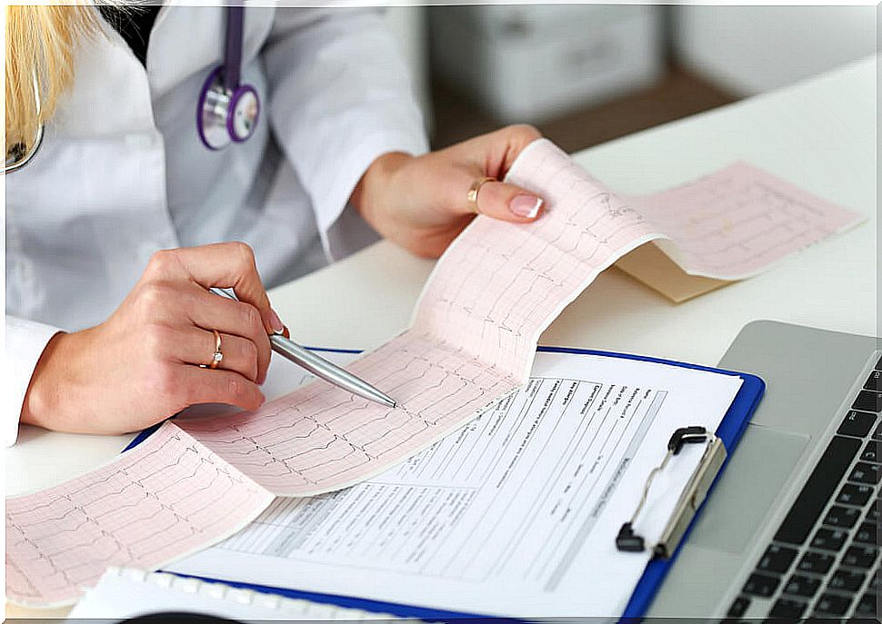 electrocardiogram in Brugada syndrome