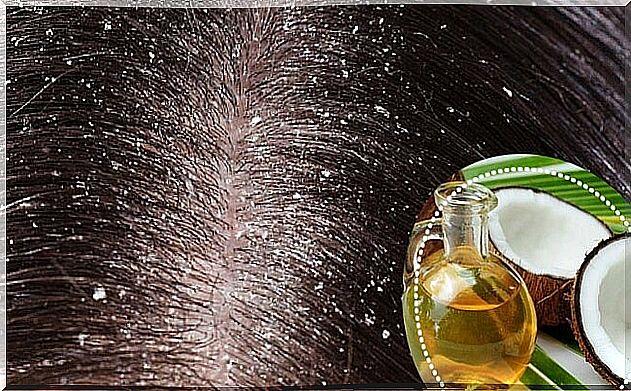 Dandruff or flaking?  What are they and how do they fight?