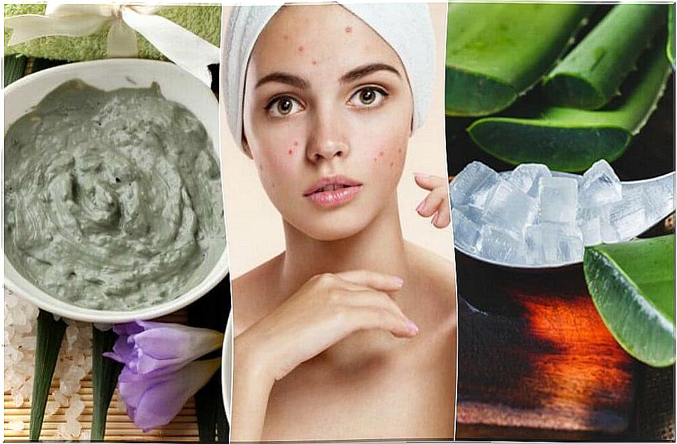 How to treat facial pimples.