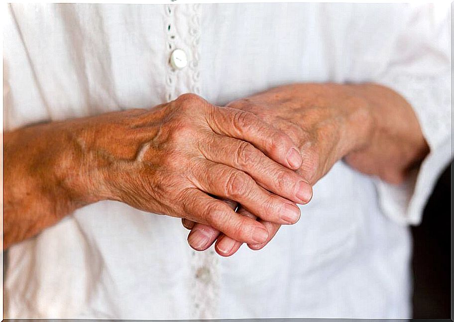 Arthritis in the hands