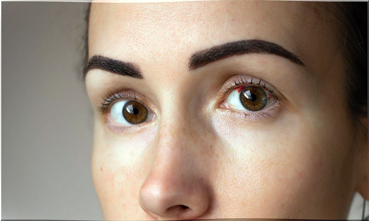 Red spots in the eyes: why do they occur?