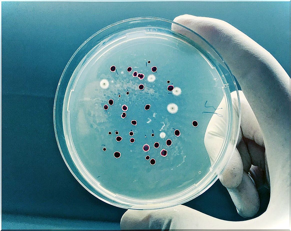 Petri dish with cultures